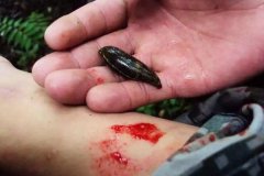 螞蟥咬人怎么辦？螞蟥怎么能殺死？